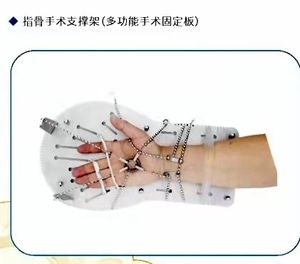 指骨手术支撑架（多功能手术固定板）